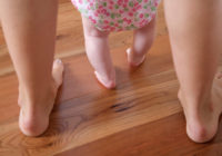 ноги матери и иксообразные ноги ребенка