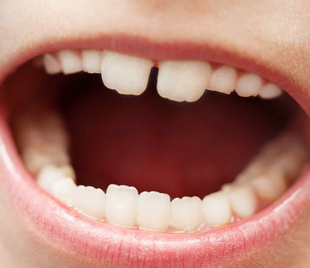 коренные зубы у ребенка